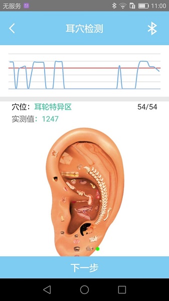 妙郎中耳穴检测